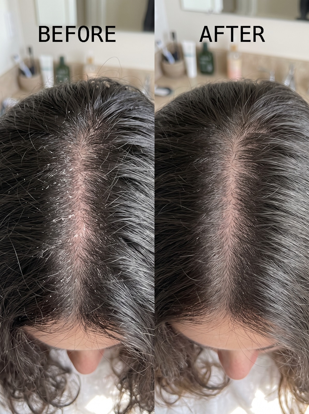 Before and After
