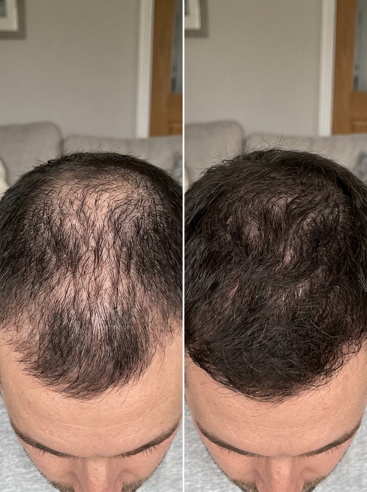 Before and After